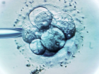 T�p Bebekler ��in Spermini Kullanmakla Su�lanan Doktora Dna Testi