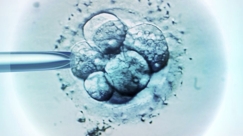 Tp Bebekler in Spermini Kullanmakla Sulanan Doktora Dna Testi