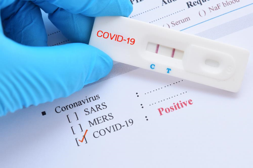 cretsiz Covid-19 koronavirs testi yapan hastaneler! stanbul, Ankara, zmir ve il il koronavirs testi yapan devlet hastaneleri nerede?