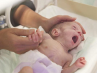 Üçüz Parmak Bebekler Sağlıklarına Kavuştu