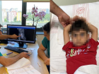 �zerinden minib�s ge�mi�ti! �drar kanal� kopan 5 ya��ndaki �ocuk zorlu operasyonla sa�l���na kavu�tu