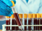 Uzmanlardan Hepatit B vir�s�ne kar�� uyard� geldi: Dakikada 2 ki�iyi �ld�rebilir, herkes tarama testi yapt�rs�n