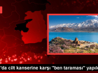 Van B�lge E�itim ve Ara�t�rma Hastanesi'nde cilt kanseri taramas� yap�ld�