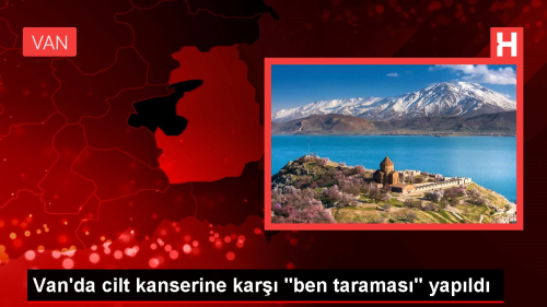 Van Blge Eitim ve Aratrma Hastanesi'nde cilt kanseri taramas yapld