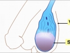 Varikosel Hastal���nda Sperm DNA Hasar�n�n �nemi Nedir?