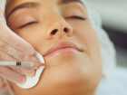 What is a non-surgical buccal fat removal? Procedure and benefits of non-surgical buccal fat removal in stanbul, Trkiye