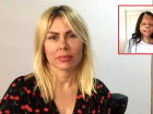 Yangında yuYüzüne doku nakli yapılan Firdevs, 2 ameliyat daha olacak