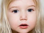 Yaz S�caklar� �ocuklarda Burun Kanamas� Nedeni Olabilir