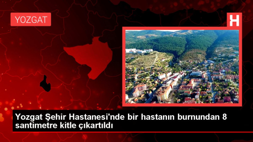 Yozgat ehir Hastanesi'nde bir hastann burnundan 8 santimetre kitle kartld