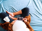 Yumurta dondurma nedir? Yumurta dondurma i�lemi nas�l yap�l�r, kimlere uygulan�r?