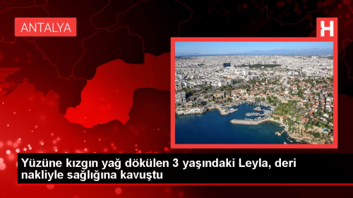 Yzne kzgn ya dklen 3 yandaki Leyla, deri nakliyle salna kavutu