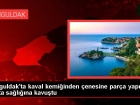 Zonguldak'ta kaval kemiğinden çenesine parça yapılan hasta sağlığına kavuştu